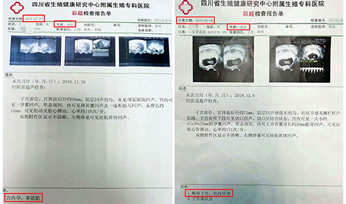 成都治疗多囊卵巢综合征的医院